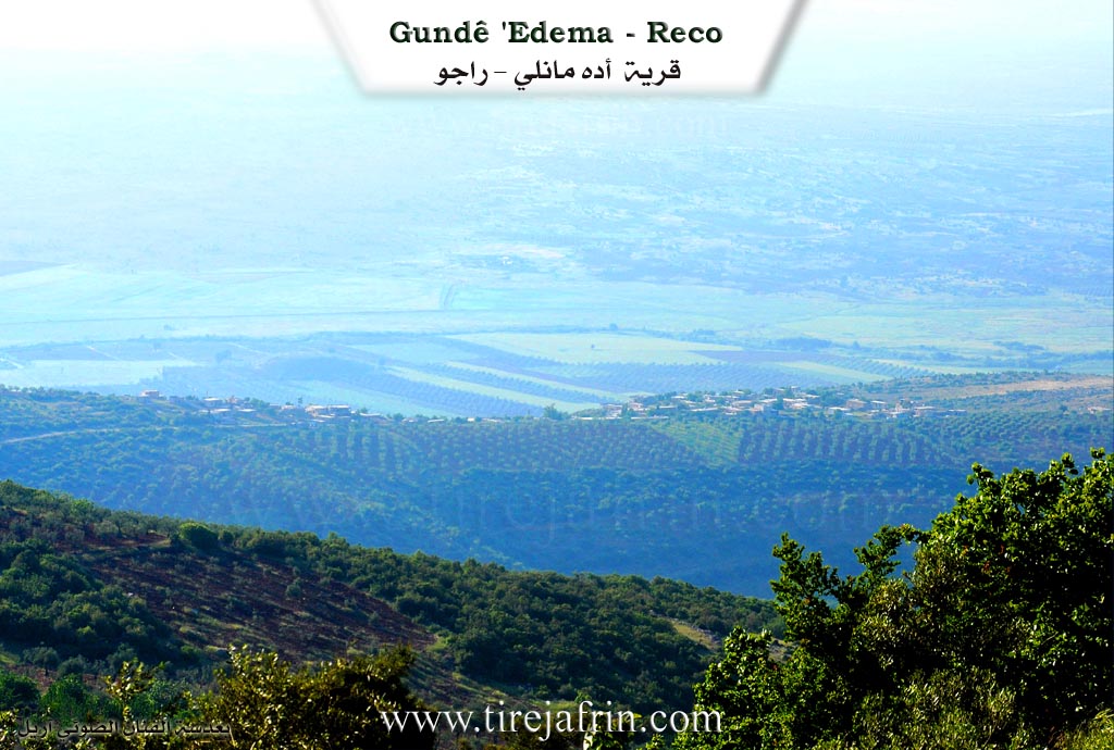 Photo of Edema